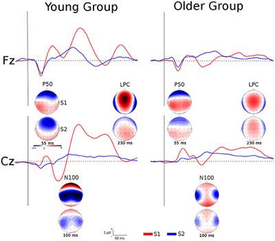 Inhibitory Control Impairment on Somatosensory Gating Due to Aging: An Event-Related Potential Study